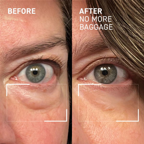 Massage Eye Cream