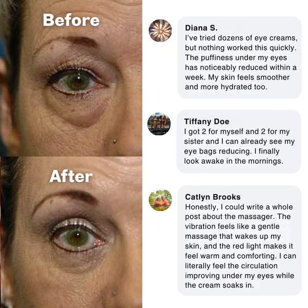 Massage Eye Cream